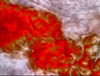 fever_140