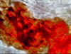 fever_141