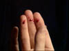 fever_290