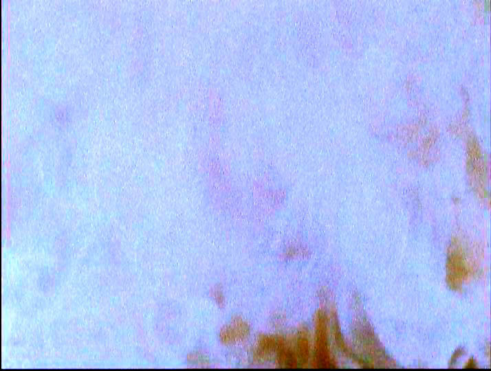 human_390